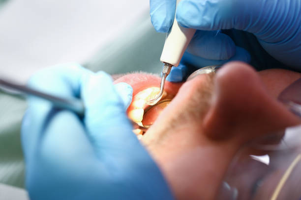 Best Teeth Whitening  in Camp Hill, AL