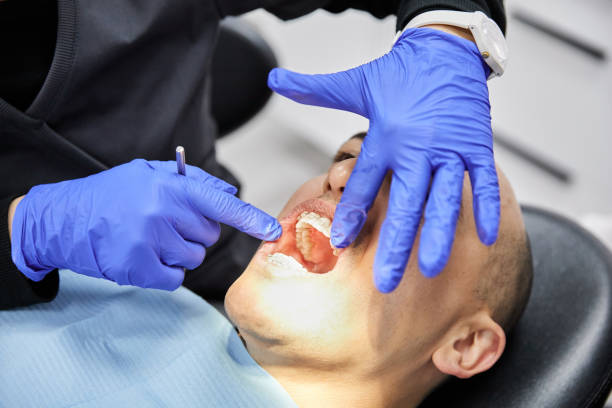 Best Chipped Tooth Repair Near Me  in Camp Hill, AL